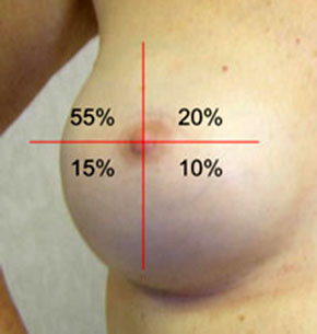 Brust brustkrebs sehr kleine Kleine Brüste